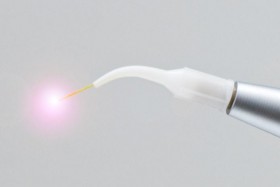 Il laser in odontoiatria - MEDIADENT SARZANA